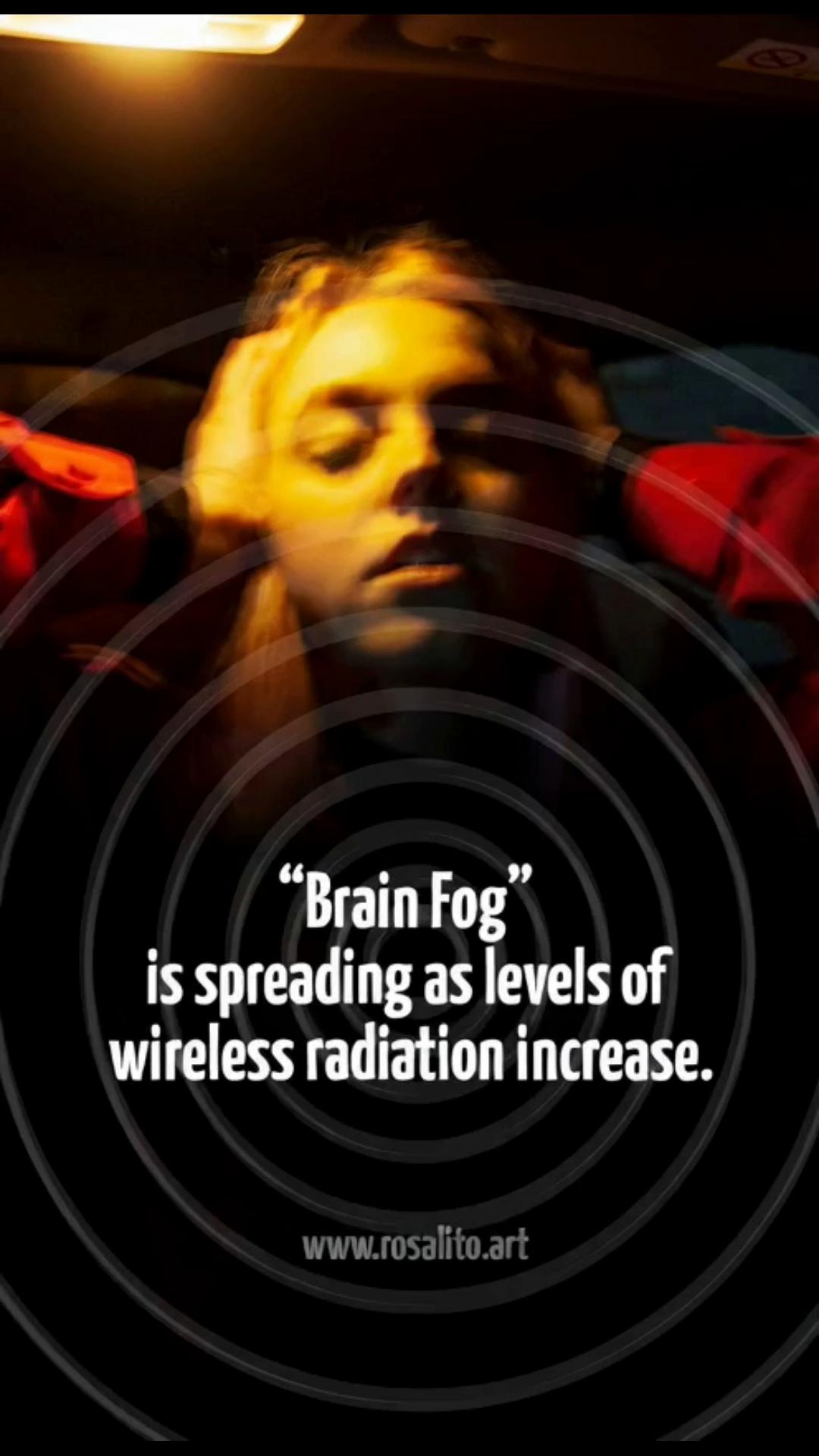 Brain Fog